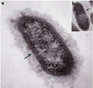 Crenarchaeota CHS Crenarchaeota