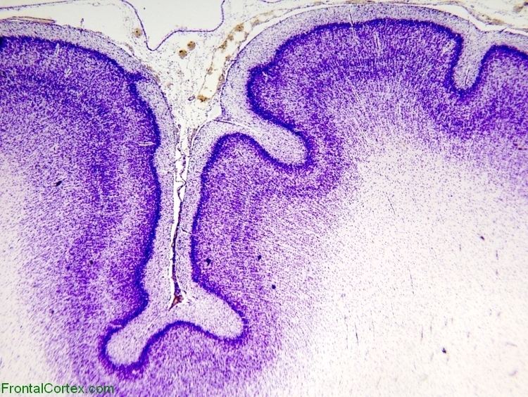 Cresyl violet gliageekCresyl violetimmature cerebral cortexjpg