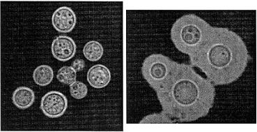 Cryptococcus gattii httpsuploadwikimediaorgwikipediacommons55