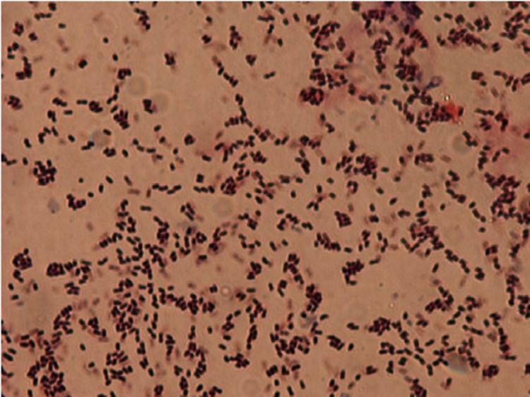 Curtobacterium Characteristic morphological features of Curtobacterium Figure