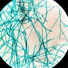 Cyanobacteria httpsuploadwikimediaorgwikipediacommonsthu