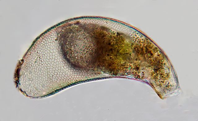 Cyphoderia Cyphoderia Microworld