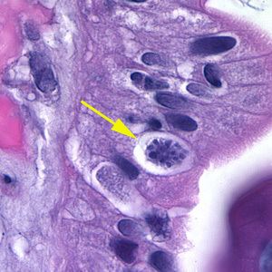 Cystoisospora CDC DPDx Cystoisosporiasis