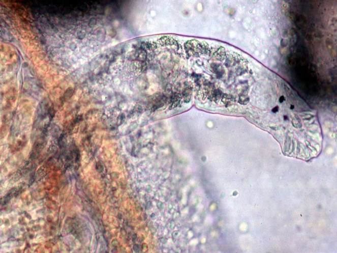 Adult dactylogyrus showing its 4 eye spots