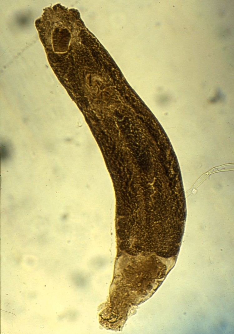 Dactylogyrus extensus