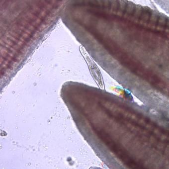 Dactylogyrus on gill filaments