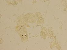 Dactylogyrus vastator httpsuploadwikimediaorgwikipediacommonsthu