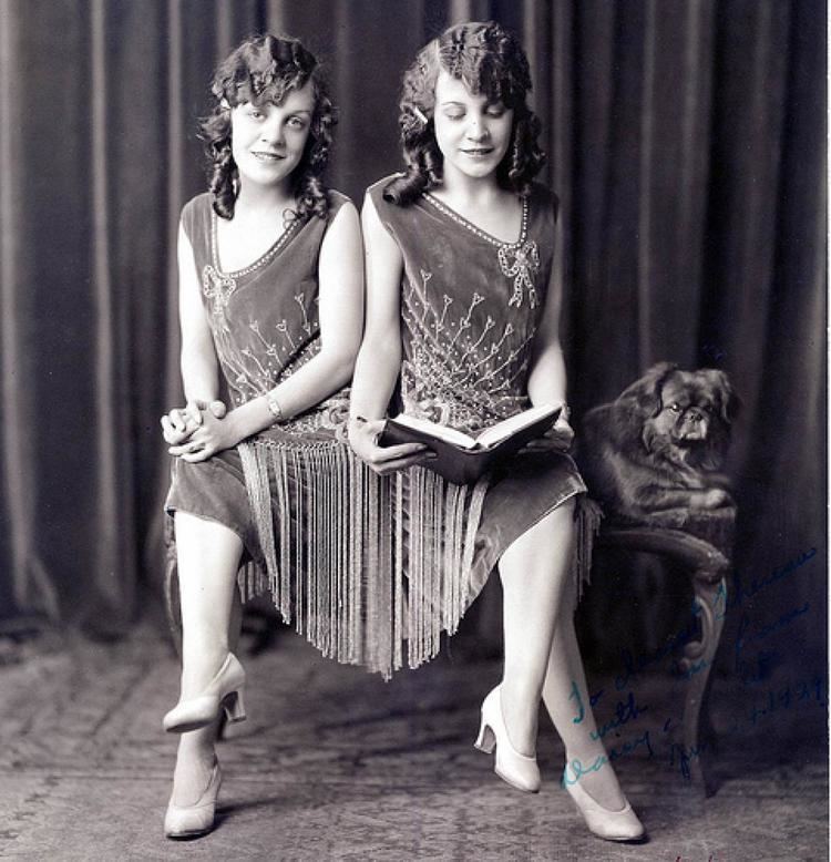 Daisy and Violet Hilton Conjoined Twins Daisy and Violet Hilton Late 1920s