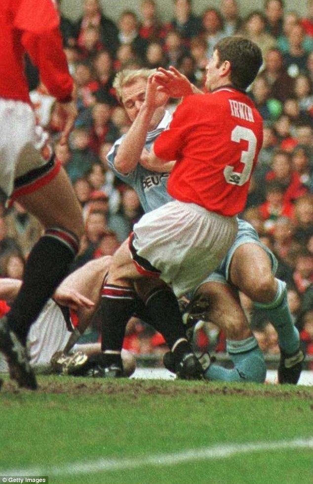 David Busst David Busst reveals astonishing scars from horror leg break against