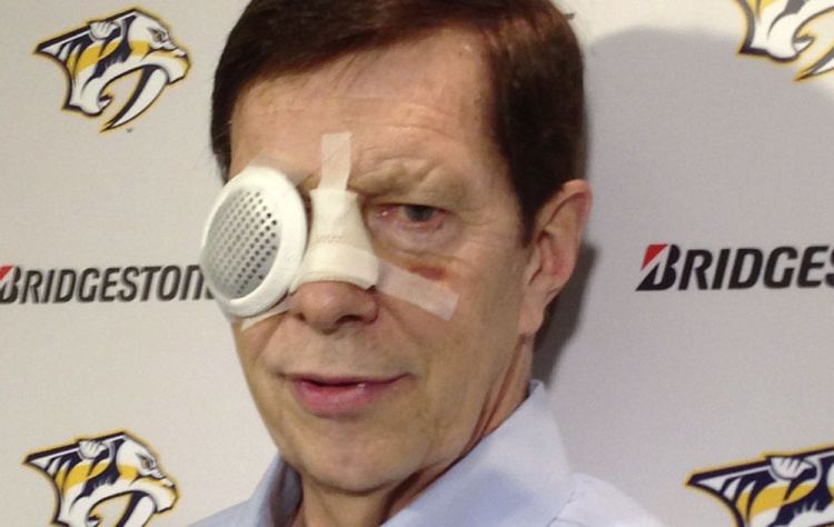 David Poile Team USA Predators GM loses sight in his eye after getting hit by a