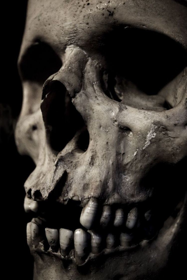 Close-up shot of a human skull
