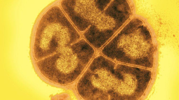 Deinococcus radiodurans Microbiology from A to Z Micropia
