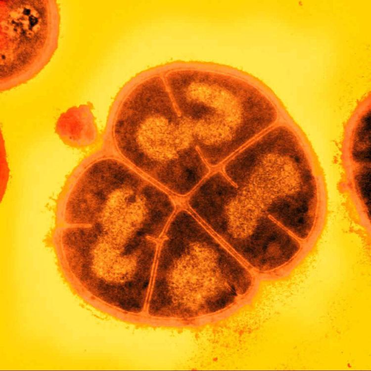 Deinococcus radiodurans Bacteria dish by trilobiteglassworks on