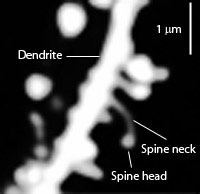 Dendritic spine
