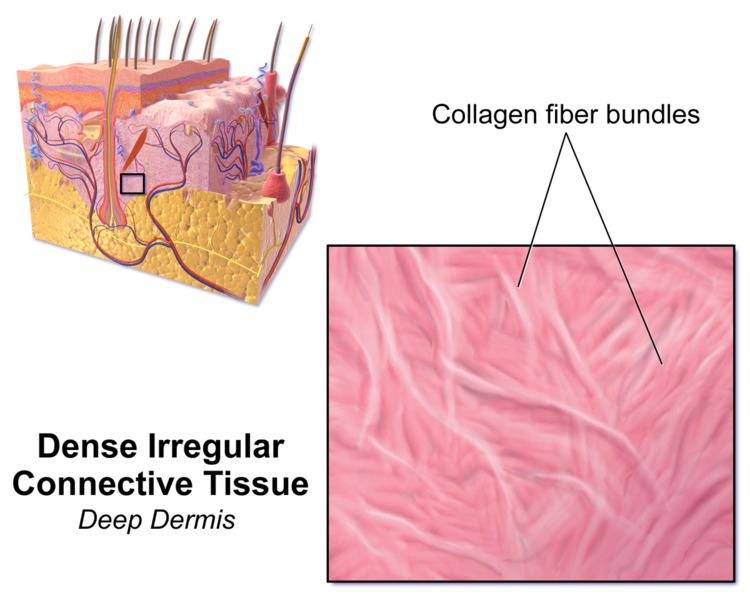 Dense irregular connective tissue