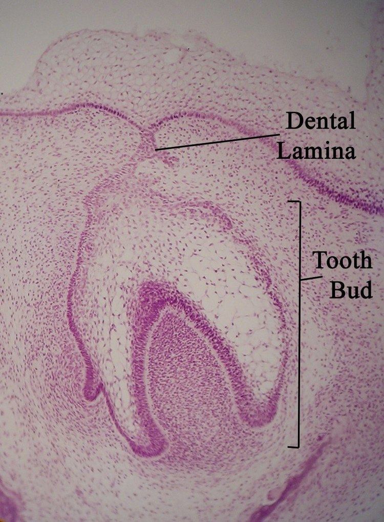 Dental lamina