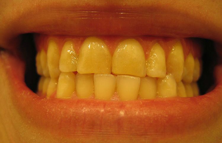 Dental midline
