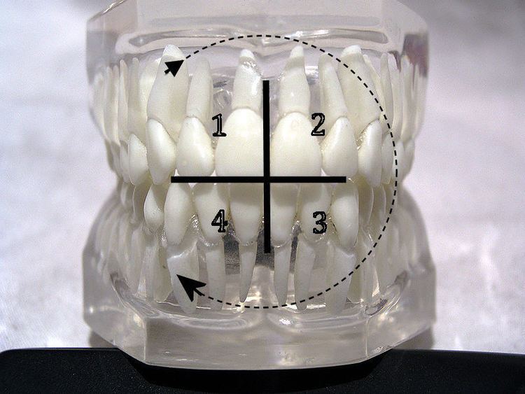 Dental notation