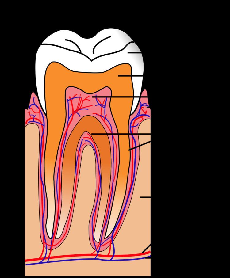 Dentin hypersensitivity
