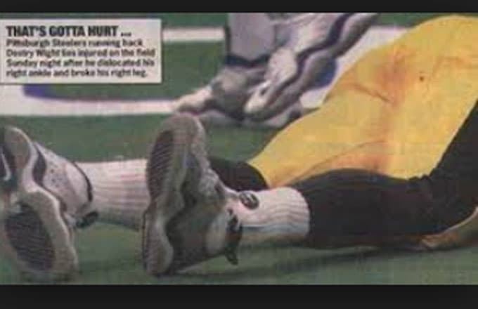 Destry Wright Destry Wright The Most Gruesome Injuries in NFL History Video