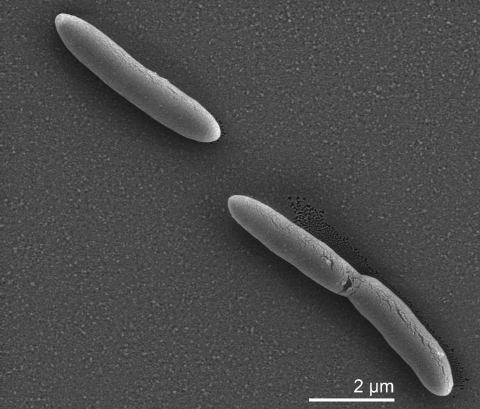 Desulfotomaculum Complete genome sequence of Desulfotomaculum acetoxidans type strain