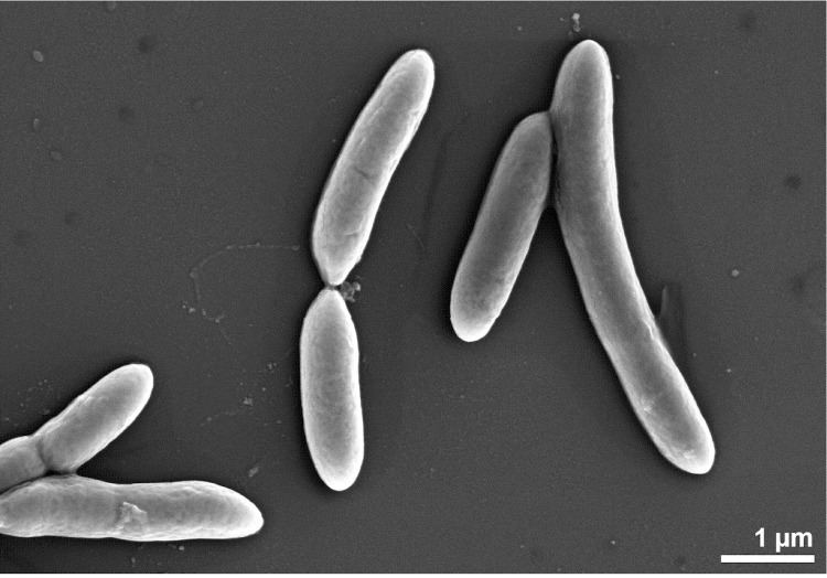 Desulfotomaculum Genome analyses of the carboxydotrophic sulfatereducers