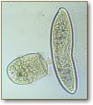 Didinium Protozoa