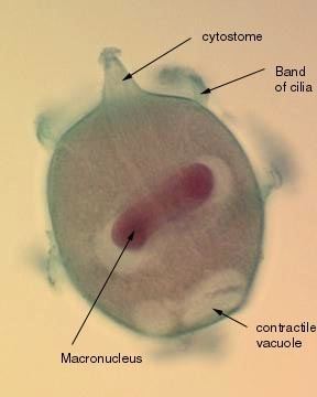 Didinium nasutum