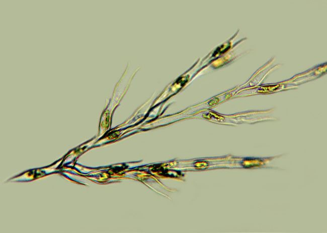 Dinobryon Dinobryon Cell contents chloroplasts are brown or goldenbrown