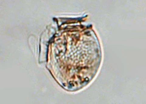 Dinophysis acuminata Dinoflagellate Dinophysis acuminata