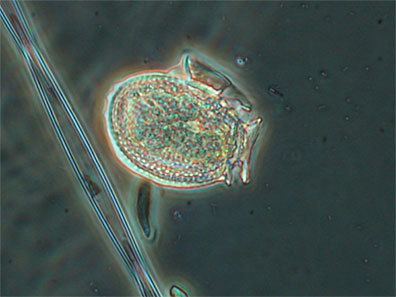 Dinophysis acuminata Dinophysis acuminata Dinoflagellate