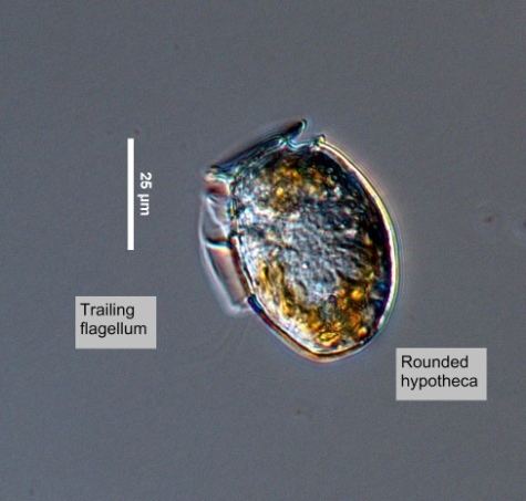 Dinophysis acuminata EOS Phytoplankton Encyclopedia Project