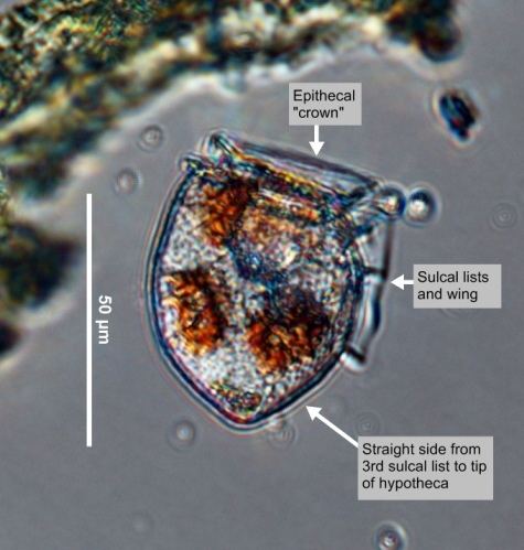 Dinophysis acuta EOS Phytoplankton Encyclopedia Project