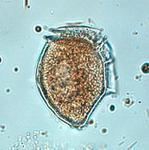 Dinophysis norvegica medianordicmicroalgaeorgsmallDinophysis20norv