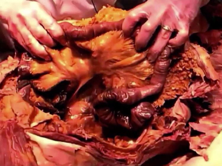 Dissection Gross Anatomy Dissections SMPH Video Library