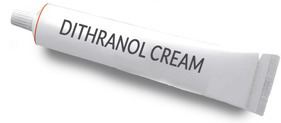 Dithranol Dithranol Cream as an Alopecia Areata Treatment