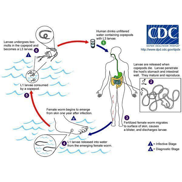 Dracunculus (nematode) The Morphology and Biology of Dracunculus medinensis