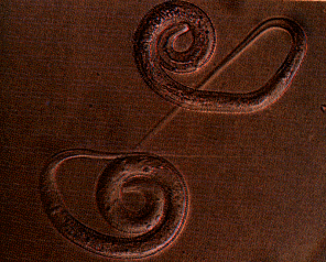 Dracunculus (nematode) Dracunculus medinensis