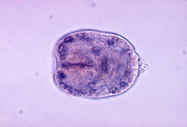 An Echinococcus granulosus under a microscope, a parasitic platyhelminth that is responsible for cystic hydatid disease.