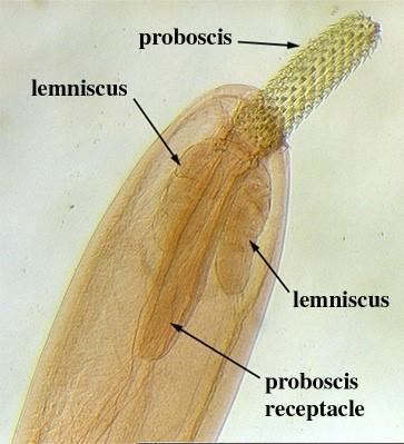 Echinorhynchus Parasitology Lab Exam PowerPoint Slide Pictures Biology 315 with