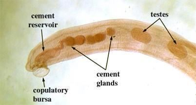 Echinorhynchus Parasitology Lab Exam PowerPoint Slide Pictures Biology 315 with