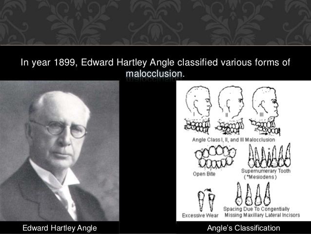 Edward Angle History Of Dentistry