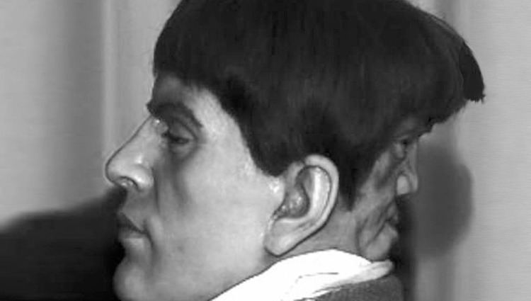 Edward Mordake Edward Mordrake Image Gallery HCPR