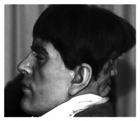 Edward Mordake picsblameitonthevoicescom072010twofacesjpg