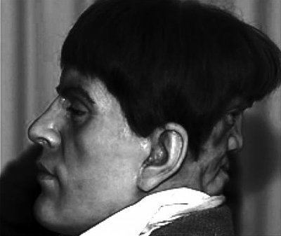 Edward Mordake media1onsugarcomfiles20140922989n1922283