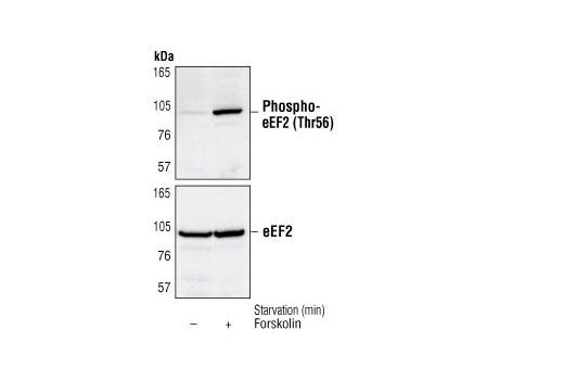 EEF2 CST eEF2 Antibody