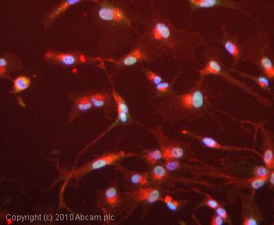 EIF2S1 AntiEIF2S1 antibody EIF2a ab5369 Abcam