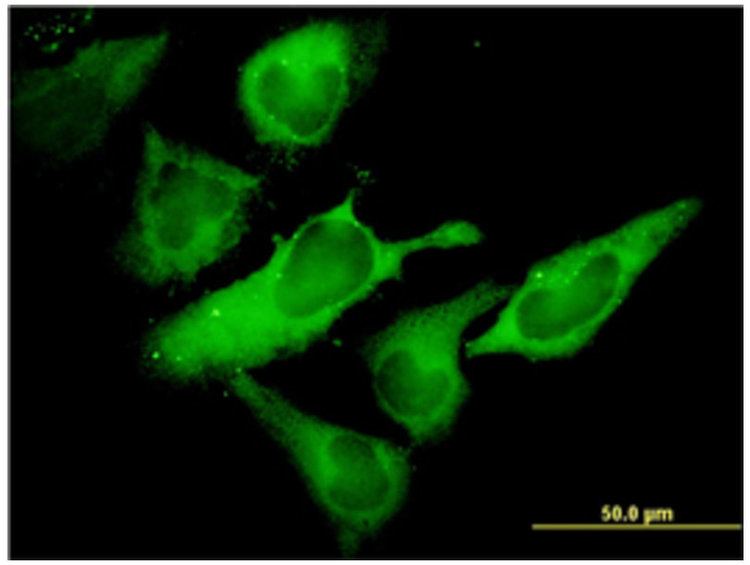 EIF2S1 antiEIF2S1 antibody AA 1316 Product No ABIN393738