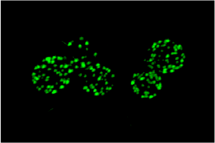 Eisosome Membranes Free FullText Membrane Compartment Occupied by Can1