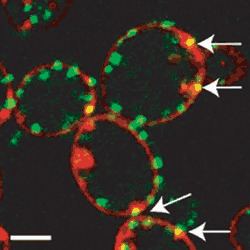 Eisosome Eisosomes endocytic portals Article Nature Cell Biology